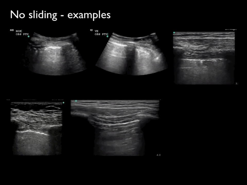 EEU case image missing